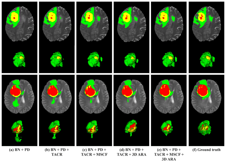 Brain Tumor Segmentation